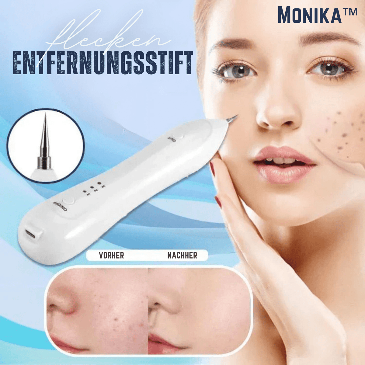 Monika – Entferner dunkler Hautflecken in nur wenigen Wochen - Sopheria
