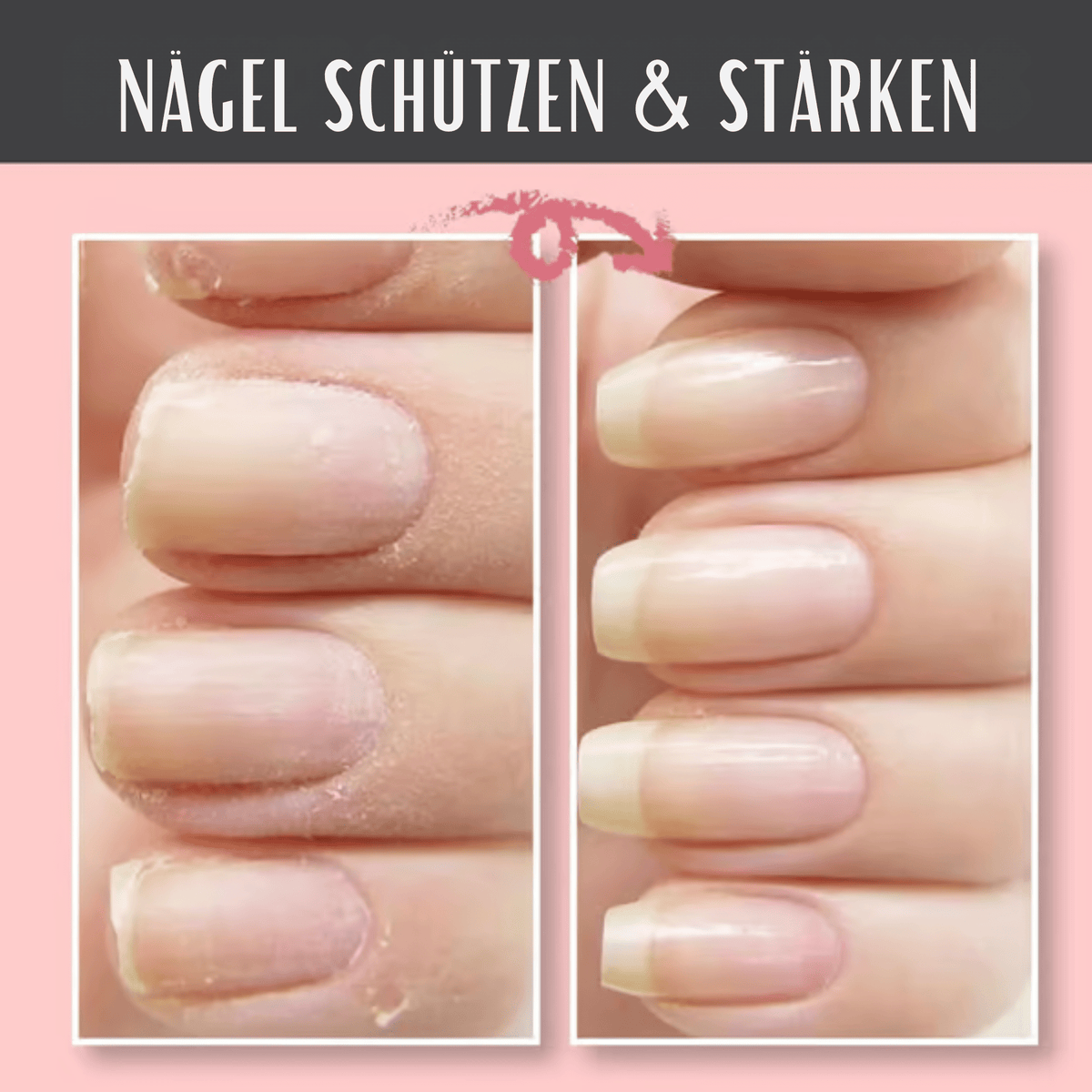 NagelNest™ / Reparierendes Und Schützendes Nagelgel - Sopheria