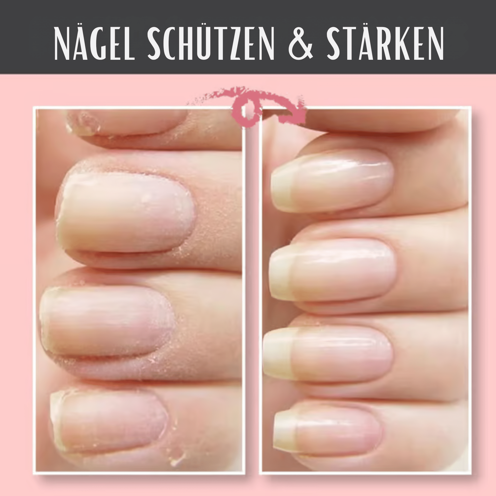 NagelNest™ / Reparierendes Und Schützendes Nagelgel - Sopheria