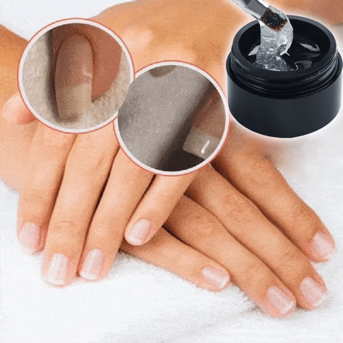 NagelNest™ / Reparierendes Und Schützendes Nagelgel - Sopheria