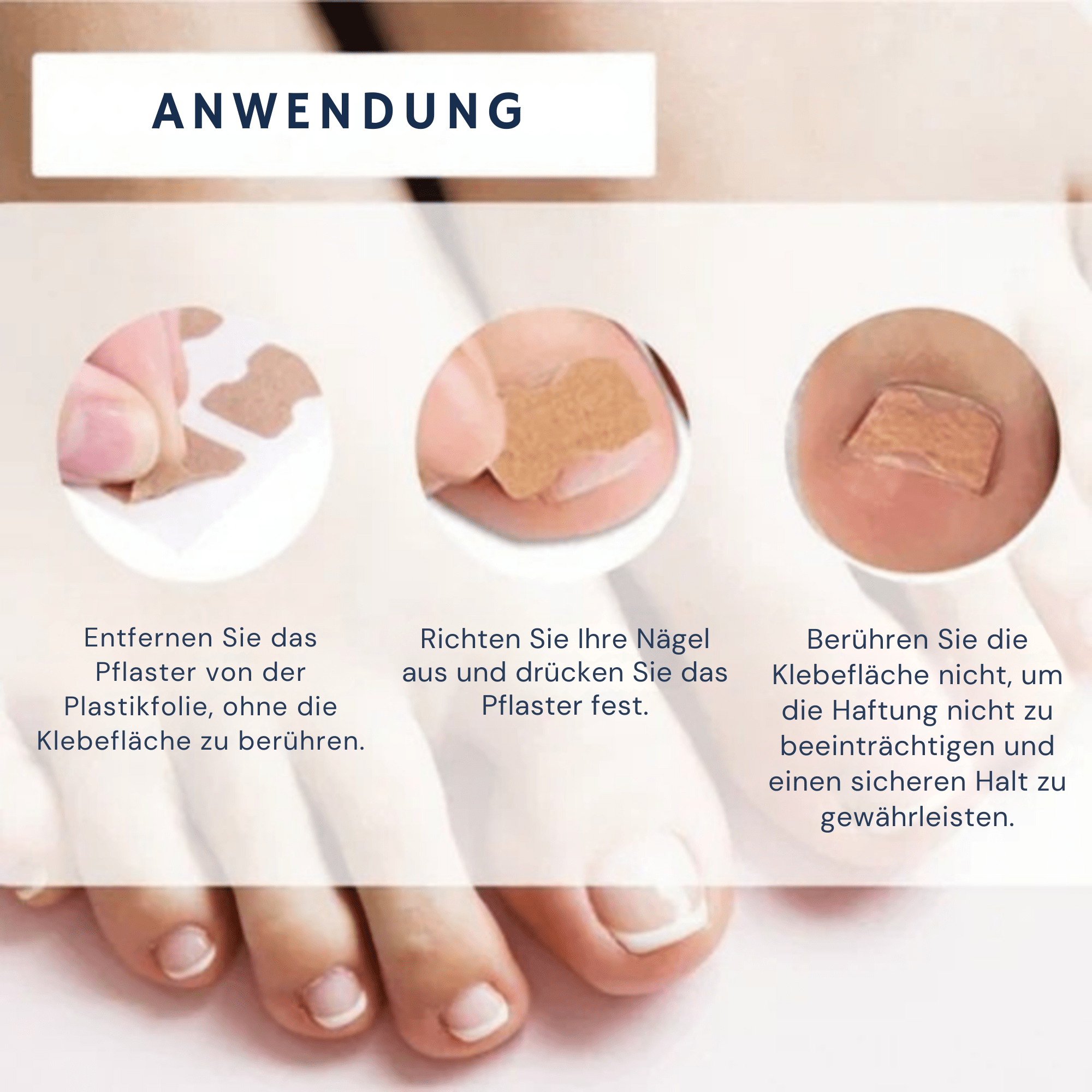 PediPure™ / Nagelkorrektur-Patches (100 Stück) - Sopheria