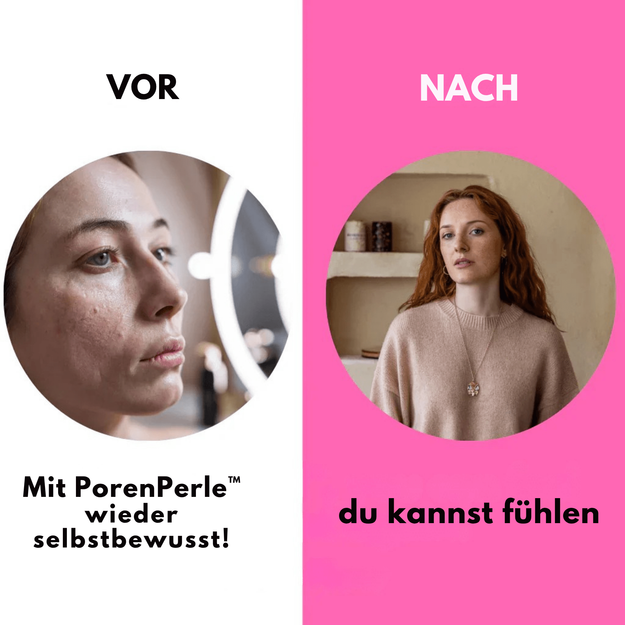 PorenPerle™ / Glatte, Strahlende Haut - Sopheria