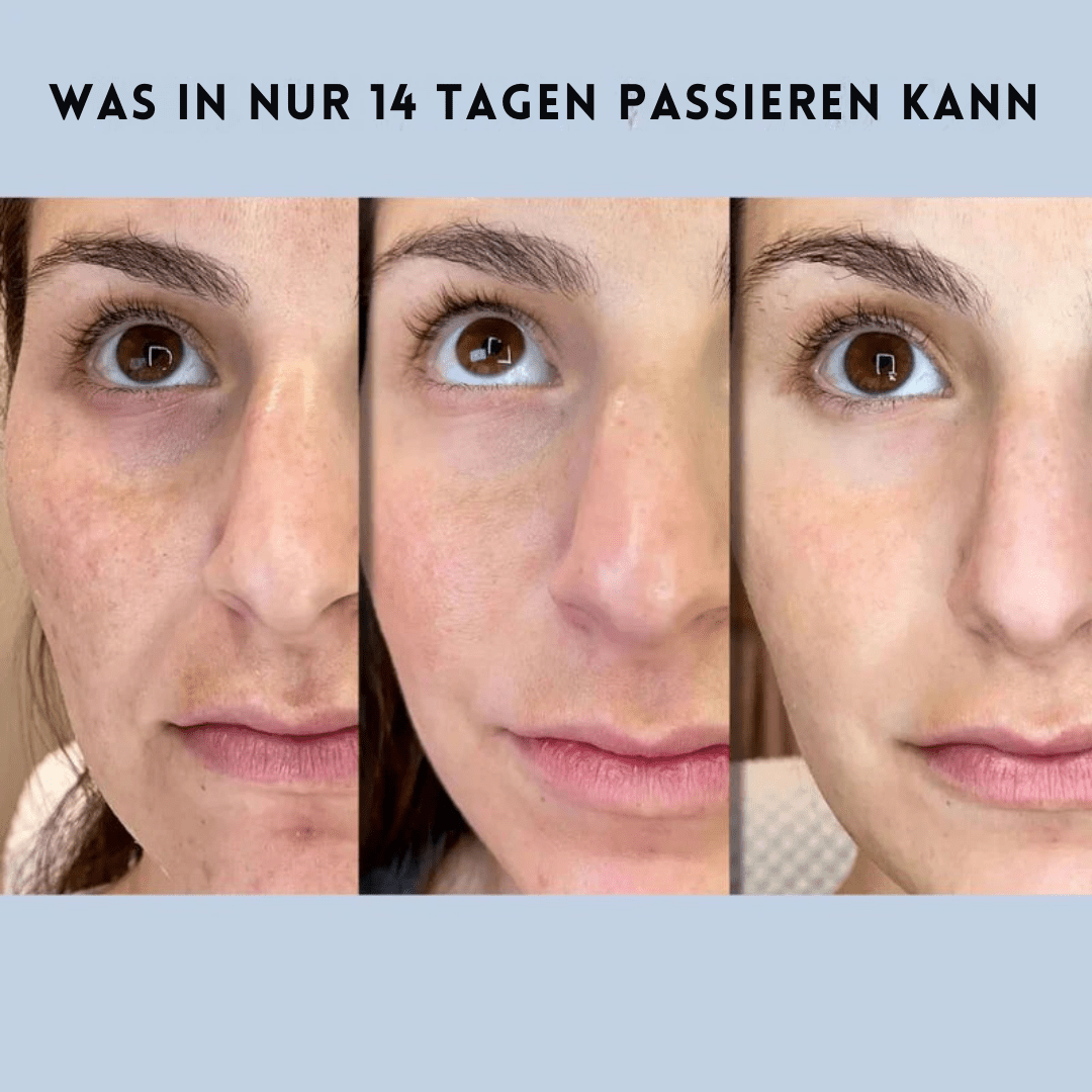 RadiantRaffinesse™ / Leuchtende Haut mit sofortigem Straffungsgefühl - Sopheria