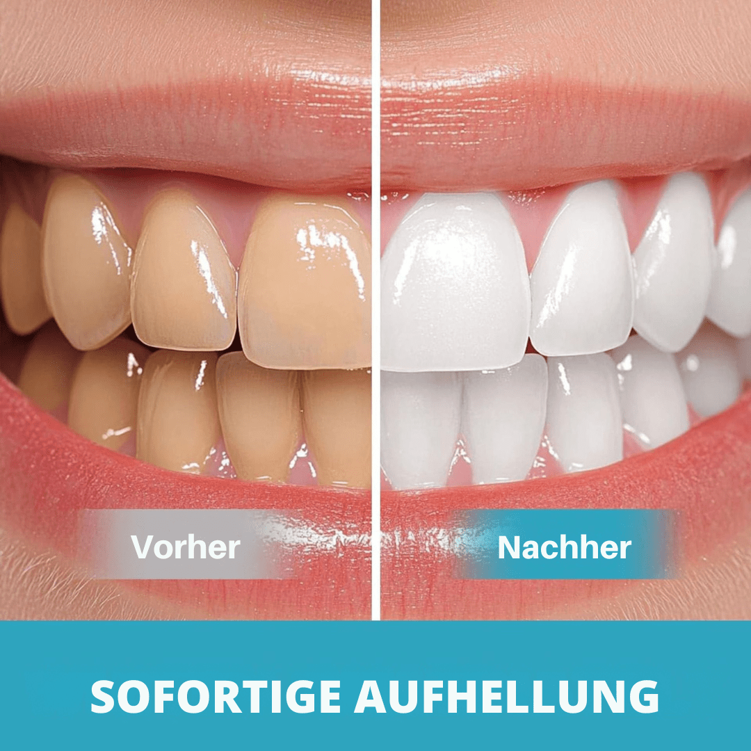 ReinRosa™ / Sanfte Aufhellung für empfindliche Zähne - Sopheria