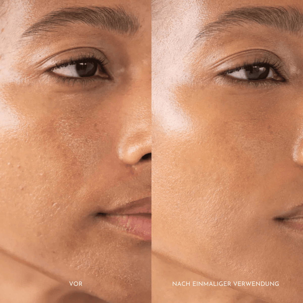 ReisRein™ / Reis-Peeling-Duo - Sopheria