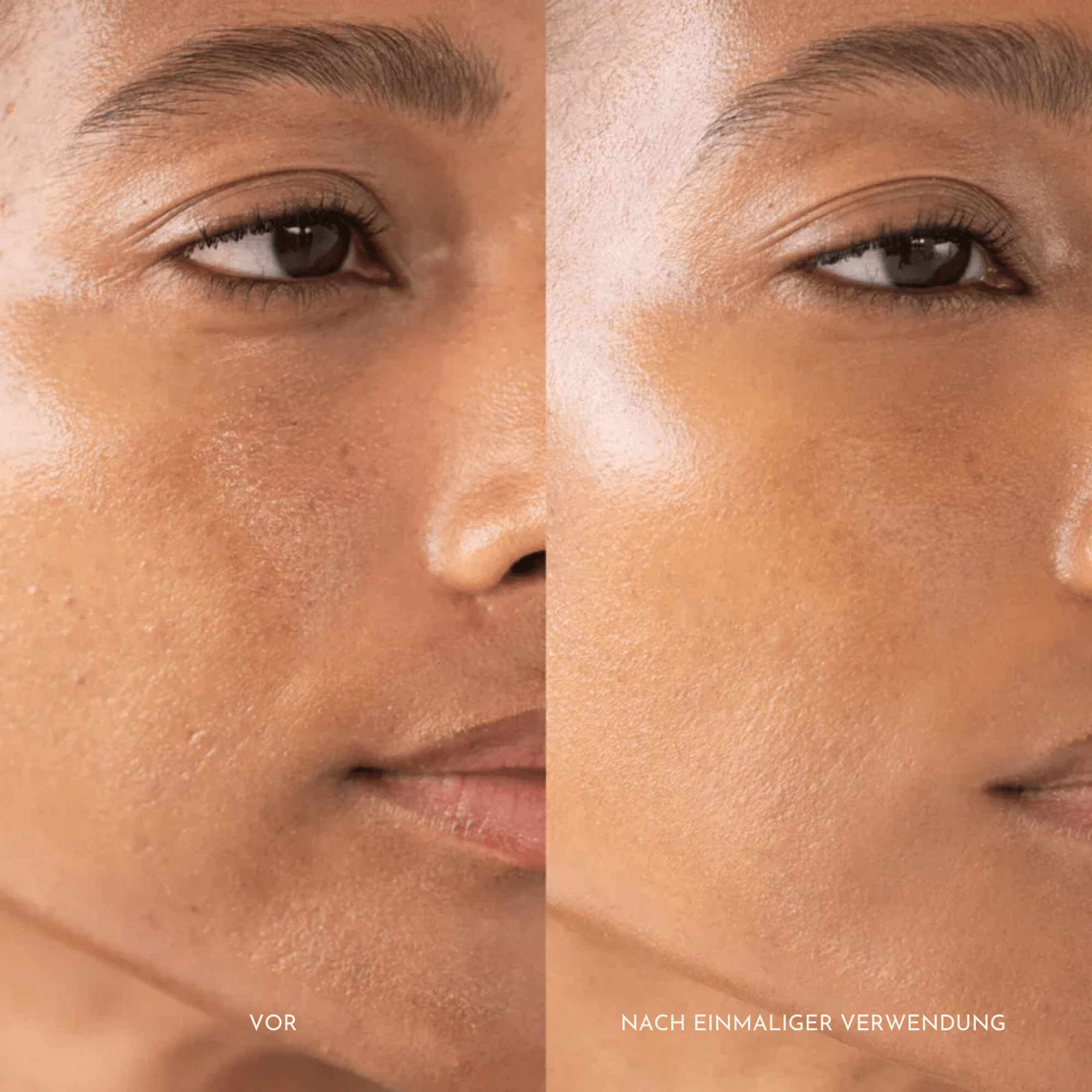 ReisRein™ / Reis-Peeling-Duo - Sopheria
