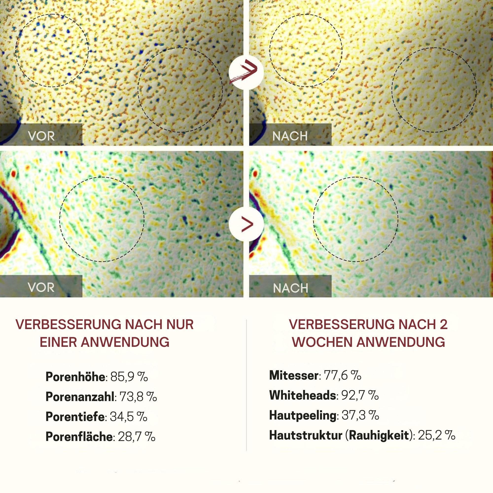 ReisRein™ / Reis-Peeling-Duo - Sopheria