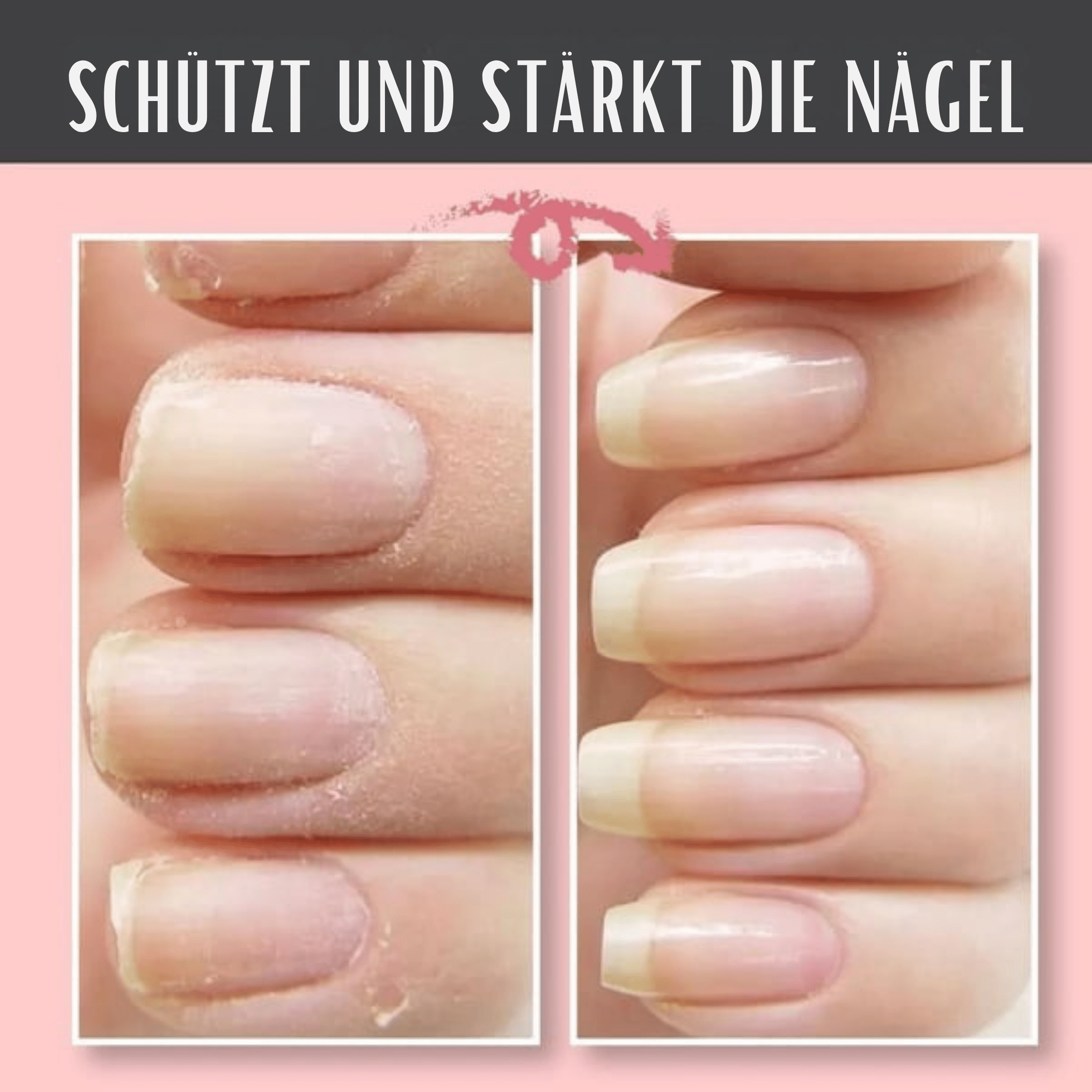 RissRetter™ / Nagelreparatur-Schutzgel - Sopheria