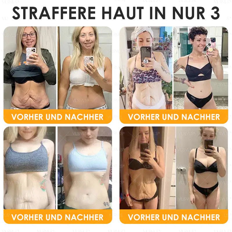 SchönSchimmer™ / Firming Anti-Aging Creme Mit Bienengift Peptiden (1+1 GRATIS) - Sopheria