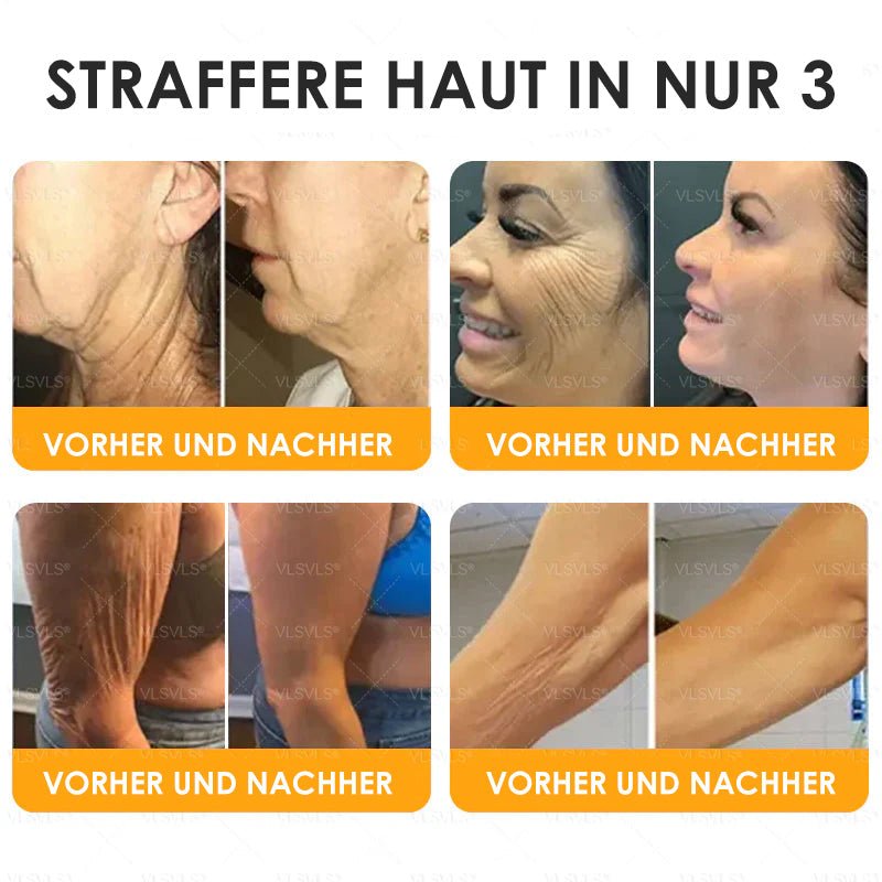 SchönSchimmer™ / Firming Anti-Aging Creme Mit Bienengift Peptiden (1+1 GRATIS) - Sopheria