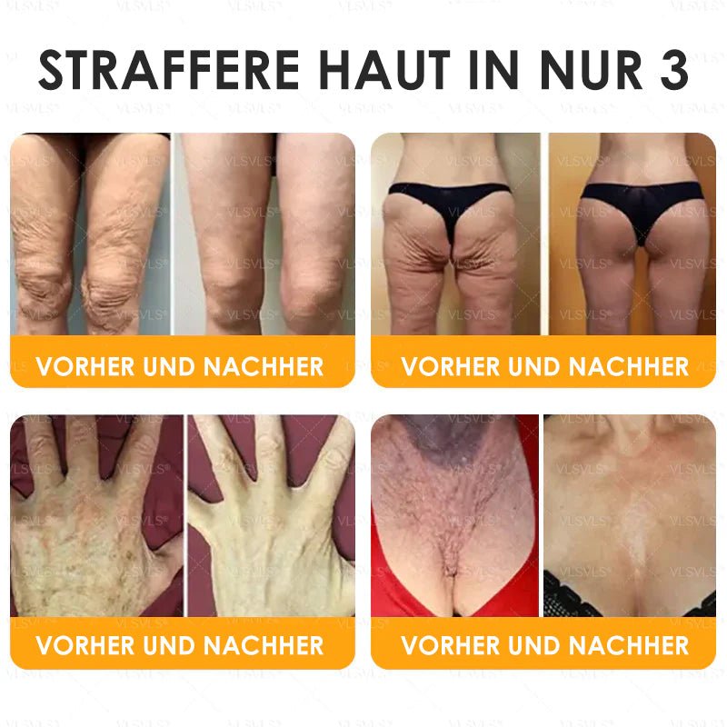 SchönSchimmer™ / Firming Anti-Aging Creme Mit Bienengift Peptiden (1+1 GRATIS) - Sopheria