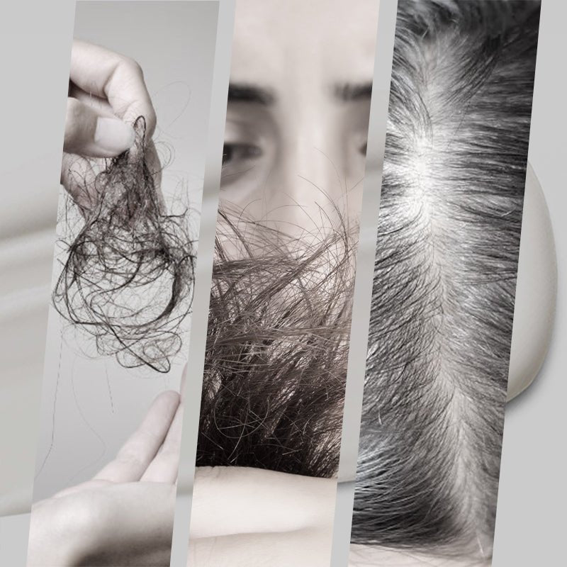 SilberSeide™ / Verwandle Haare In Ein Strahlendes, Gesundes Silber! (1+1 GRATIS) - Sopheria