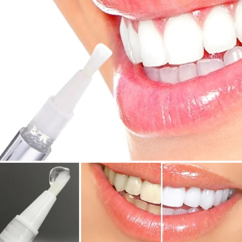 SmileSchein™ / Zahnaufhellungsstift – Strahlendes Lächeln in 10 Minuten - Sopheria