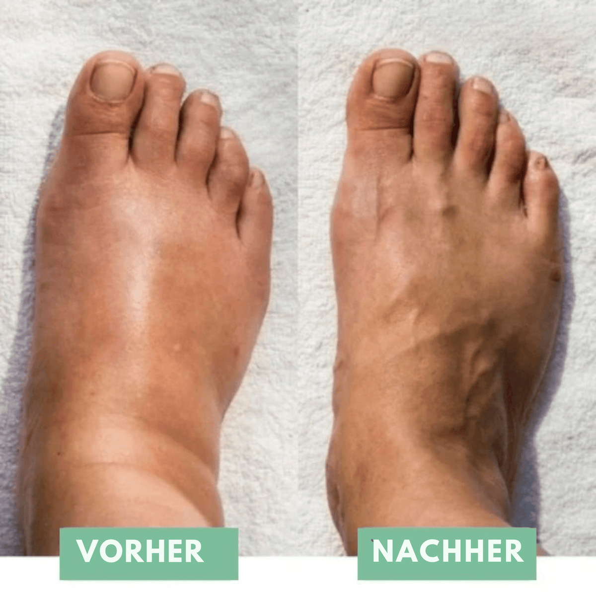 SoleSoothe™ / Die innovative EMS-Fußmassage für sofortige Erleichterung! - Sopheria