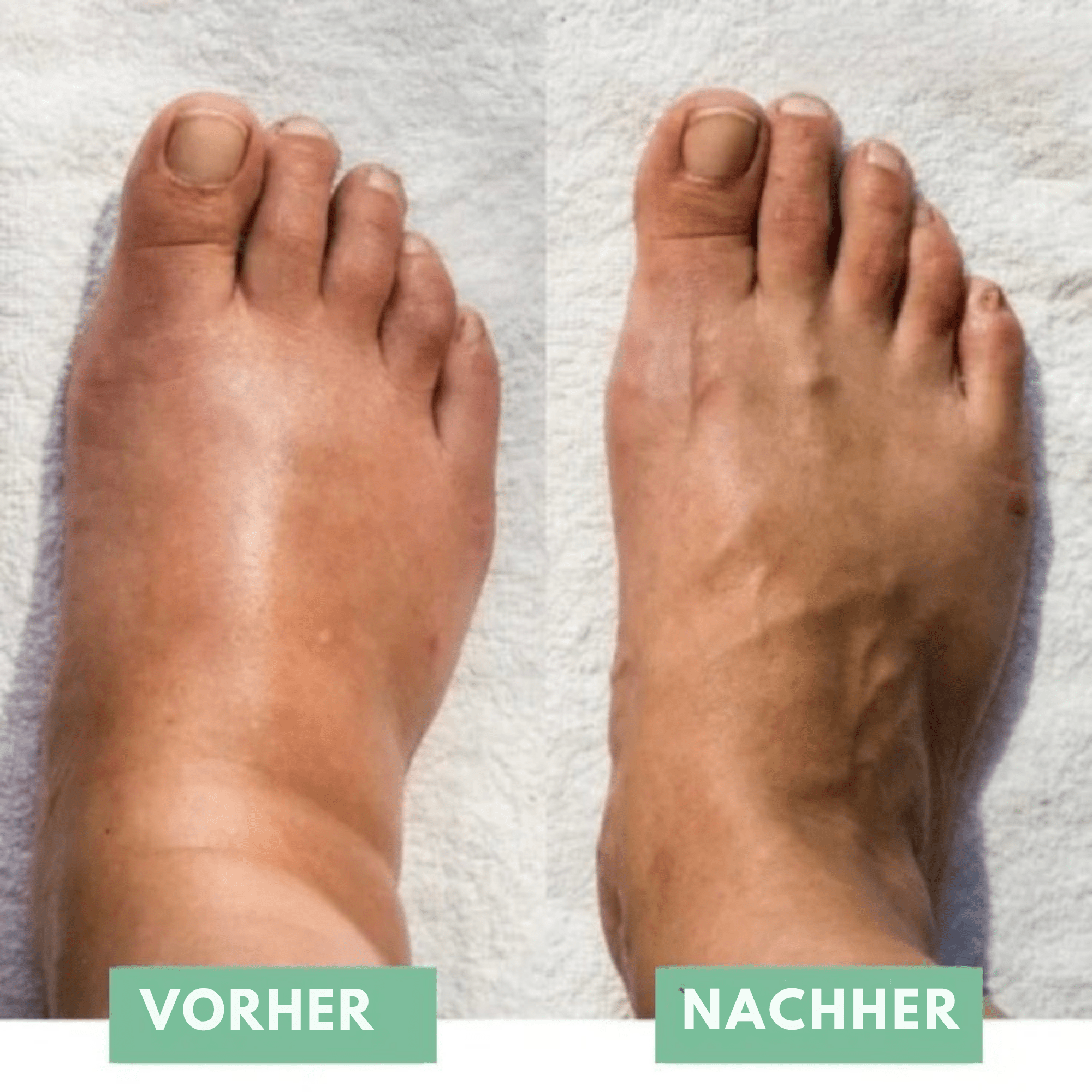 SoleSoothe™ / Die innovative EMS-Fußmassage für sofortige Erleichterung! - Sopheria