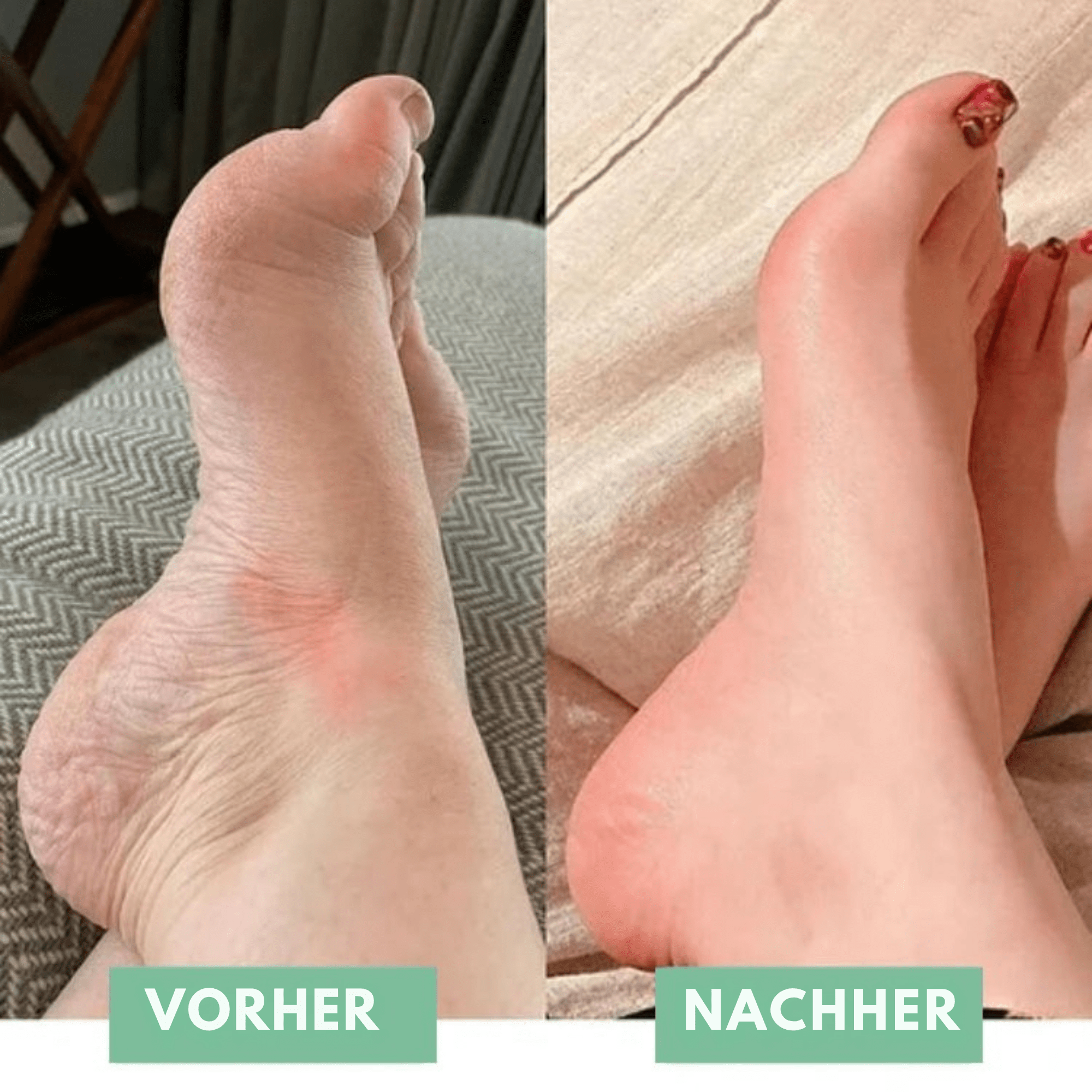 SoleSoothe™ / Die innovative EMS-Fußmassage für sofortige Erleichterung! - Sopheria