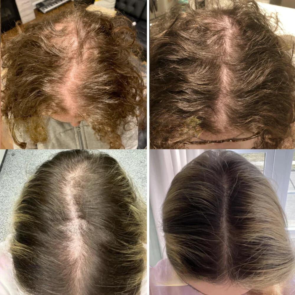 SträhnenStark™ / Ihr natürliches Haarwuchsöl - Sopheria
