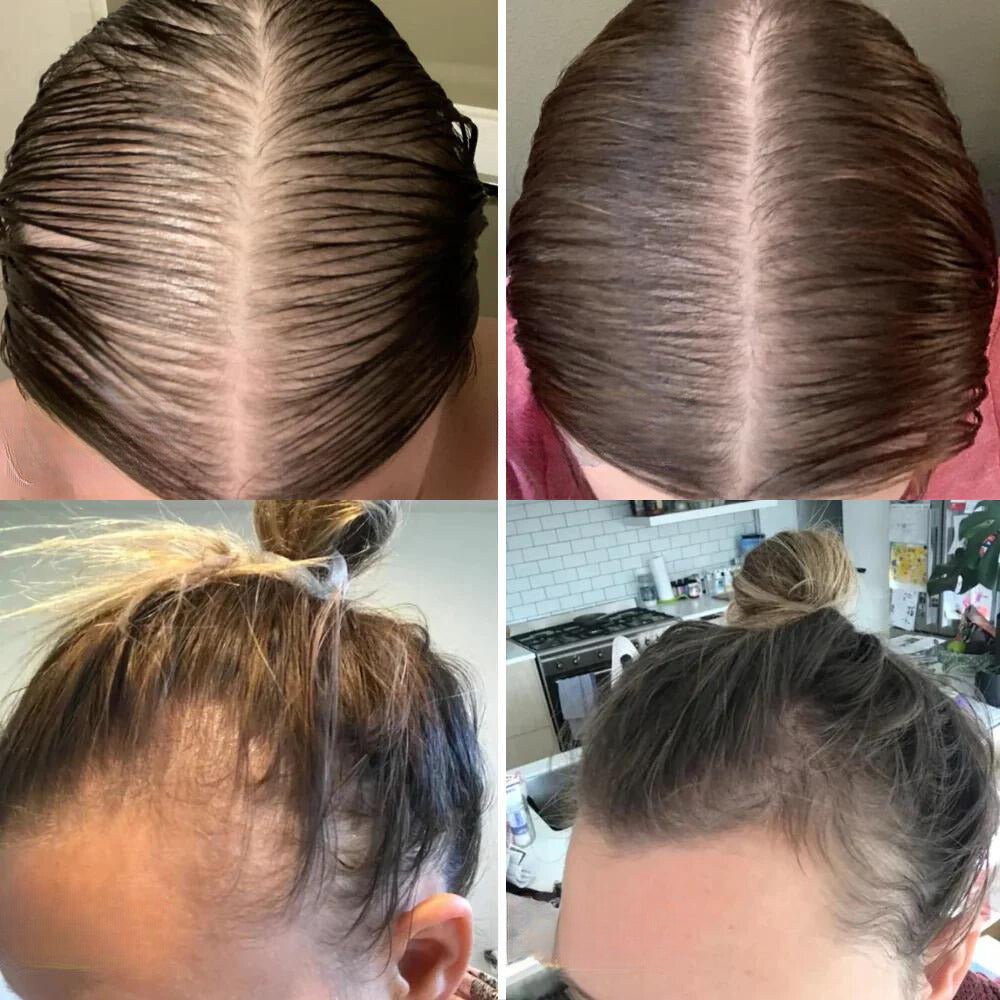 SträhnenStark™ / Ihr natürliches Haarwuchsöl - Sopheria