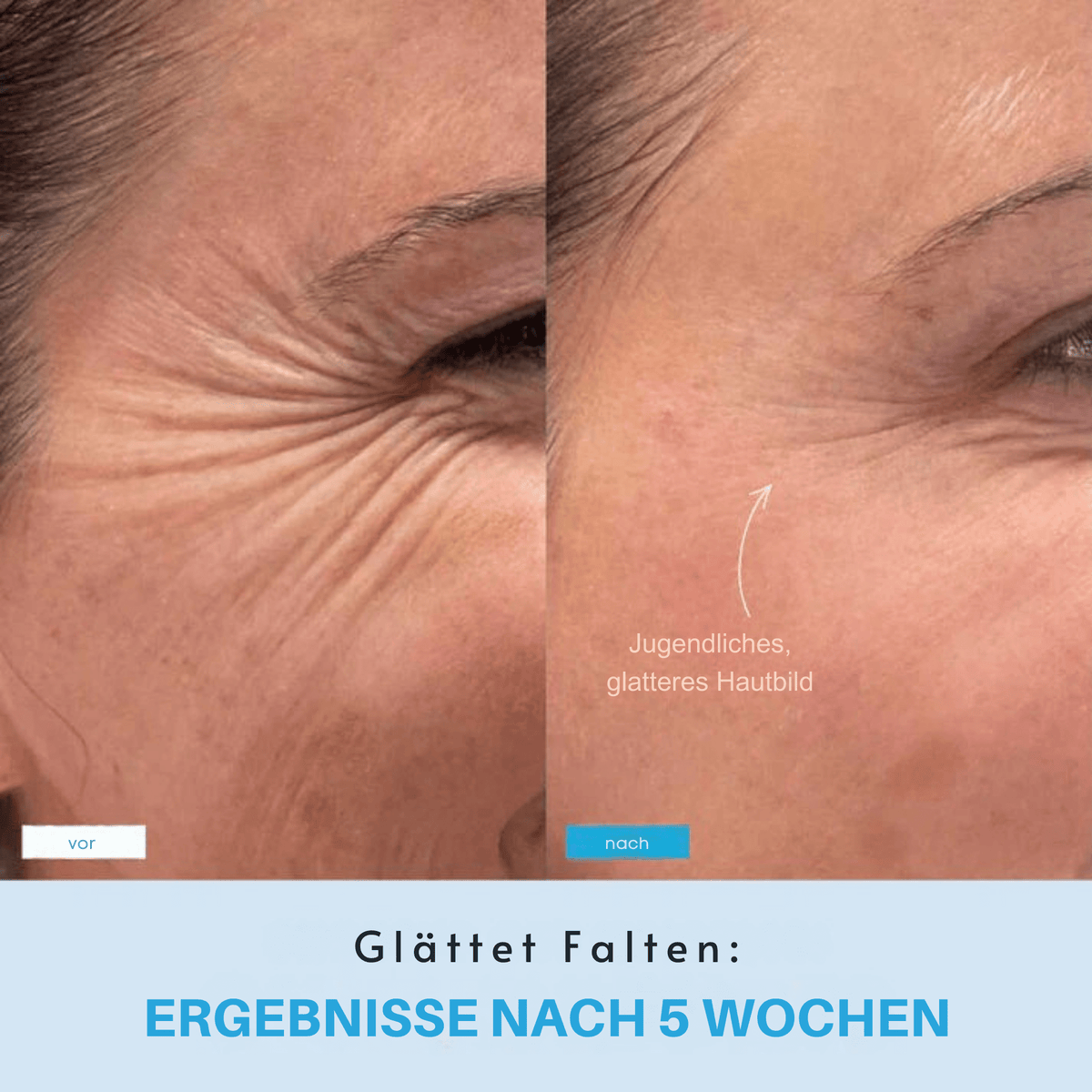 StraffStrom™ / Kombiniert LED-Lichttherapie mit Lifting-Effekten - Sopheria