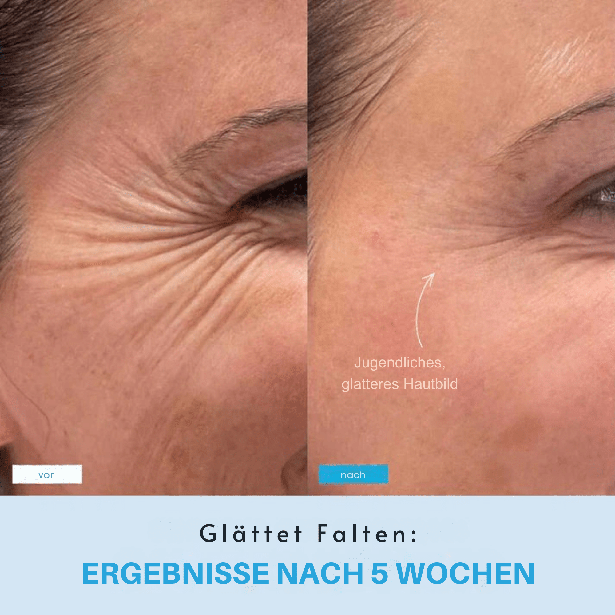 StraffStrom™ / Kombiniert LED-Lichttherapie mit Lifting-Effekten - Sopheria