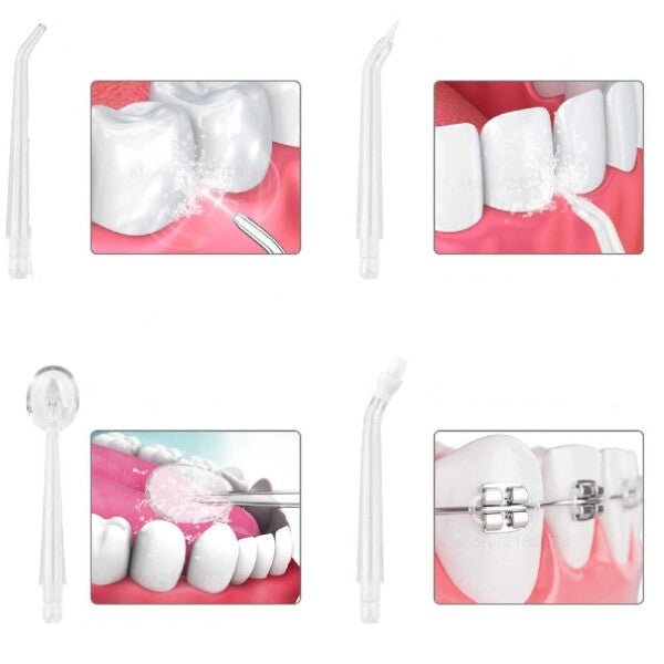StrahlSmile™ / Wiederaufladbarer Oraler Irrigator Zur Mundreinigung - Sopheria