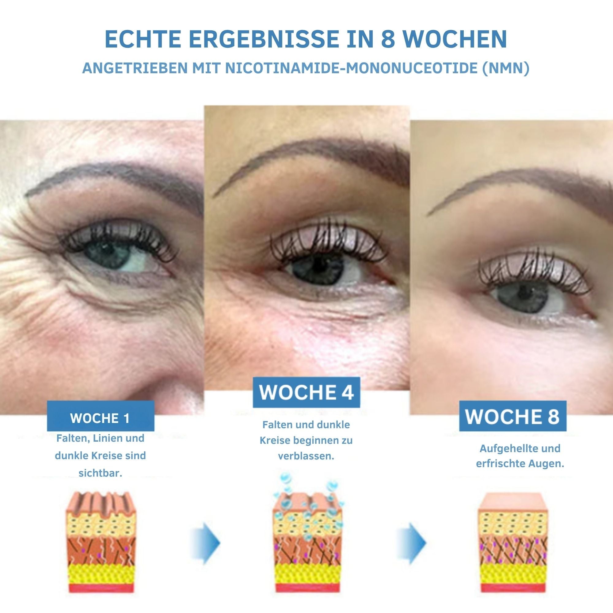StrahlStich™ / Strahlende, Junge Und Erfrischte Augen! (1+1 GRATIS) - Sopheria
