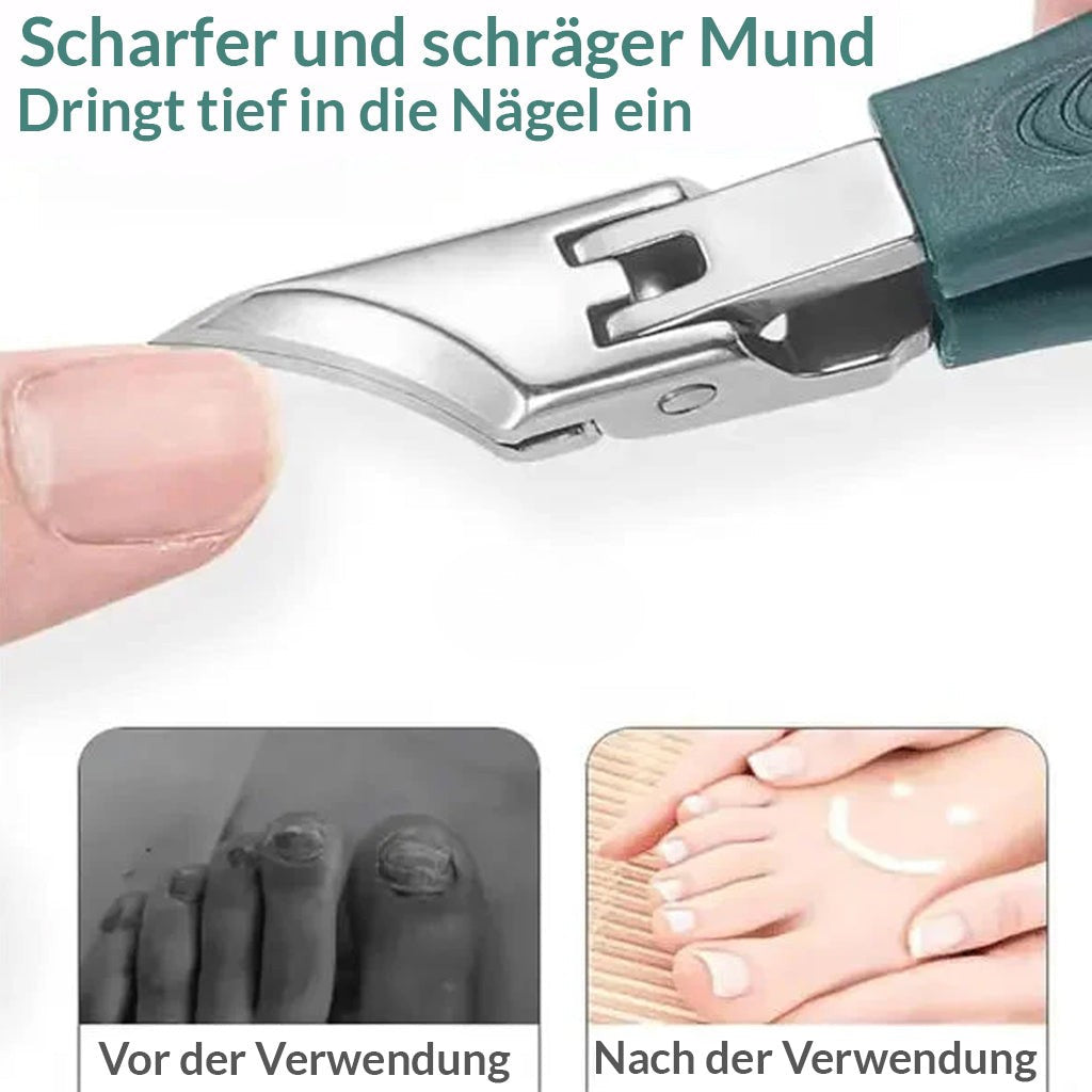 Unguia / 3-teiliges Nagelpflege-Set für eingewachsene Nägel [50% Rabatt]