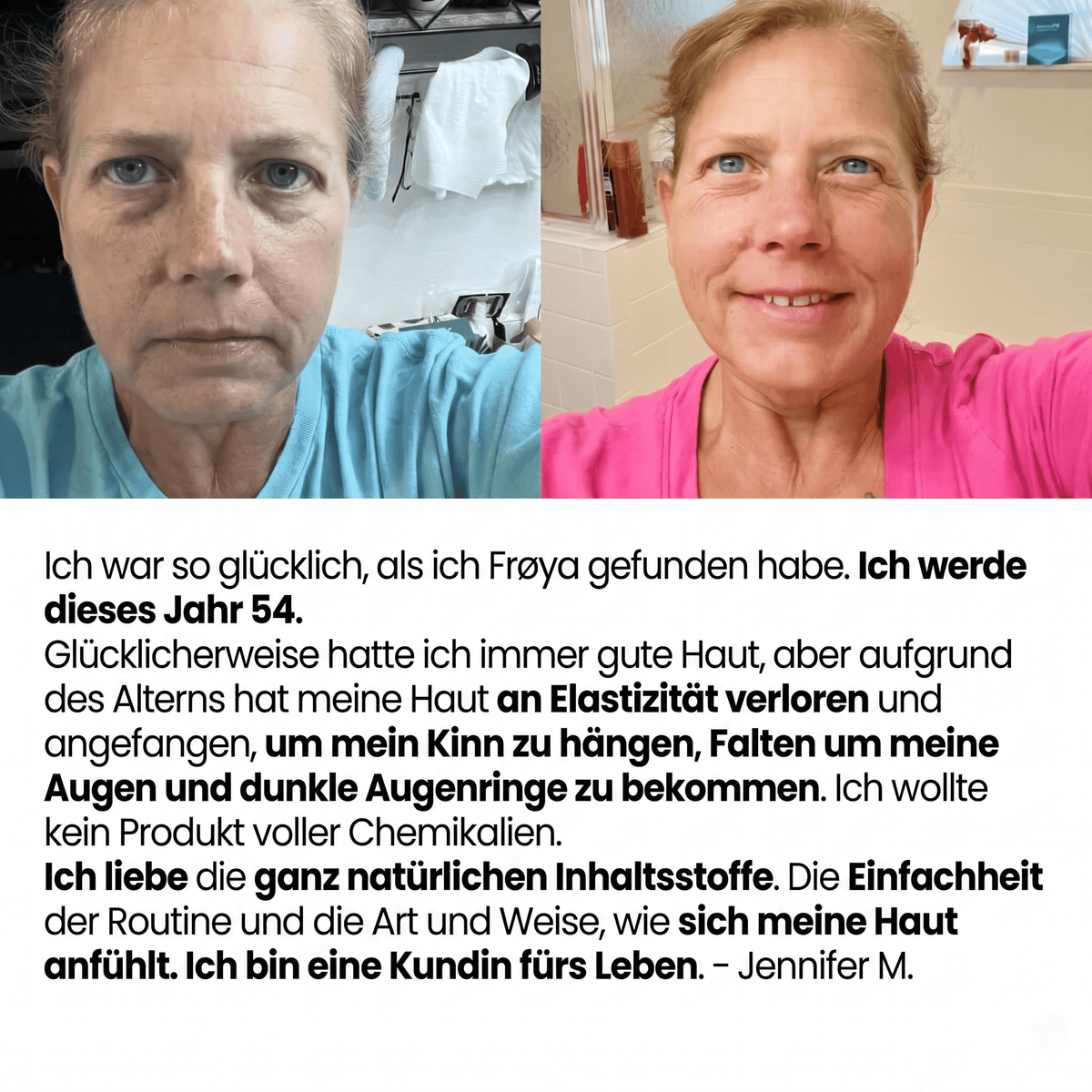 Wildblum / Wasserfreies Anti-Aging System mit arktischer Hagebutte & Sanddorn - Sopheria