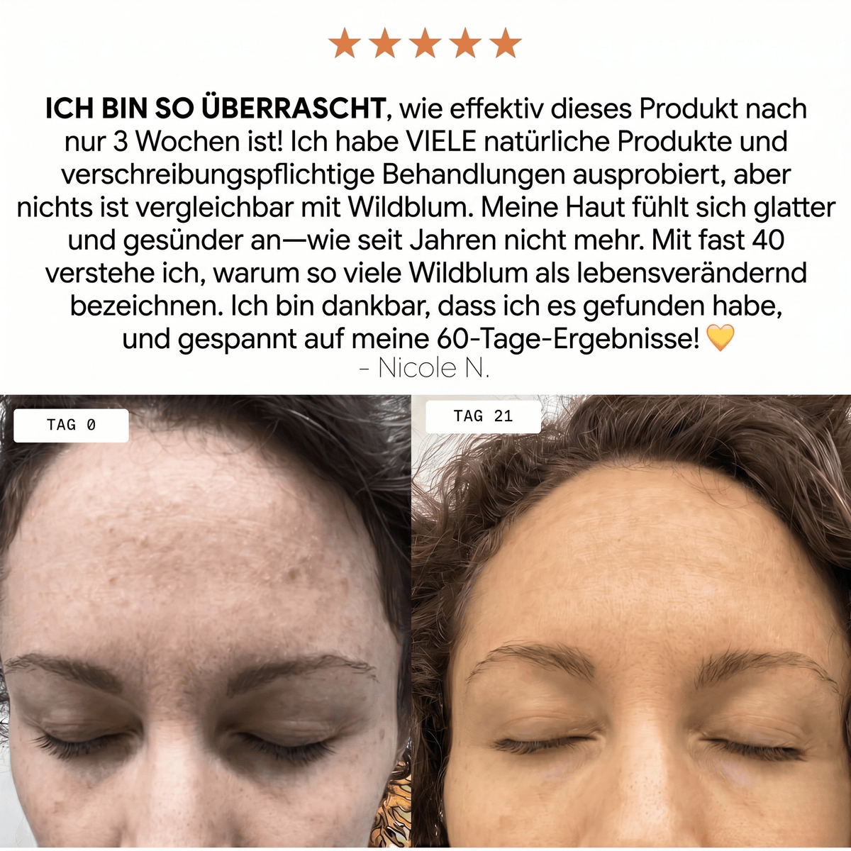 Wildblum / Wasserfreies Anti-Aging System mit arktischer Hagebutte & Sanddorn - Sopheria