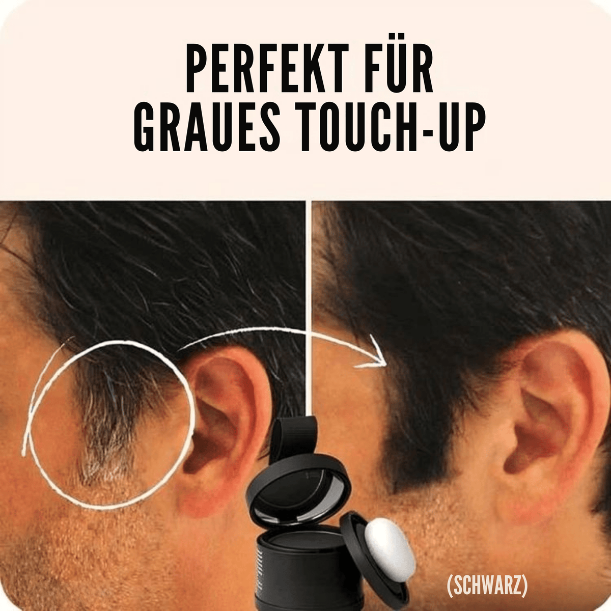 WurzelWunder™ / Kein Nachwachsen Mehr! (1+1 GRATIS) - Sopheria