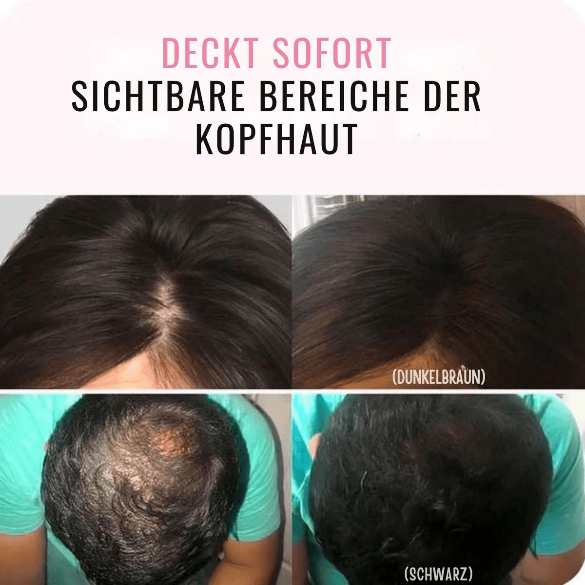 WurzelWunder™ / Kein Nachwachsen Mehr! (1+1 GRATIS) - Sopheria