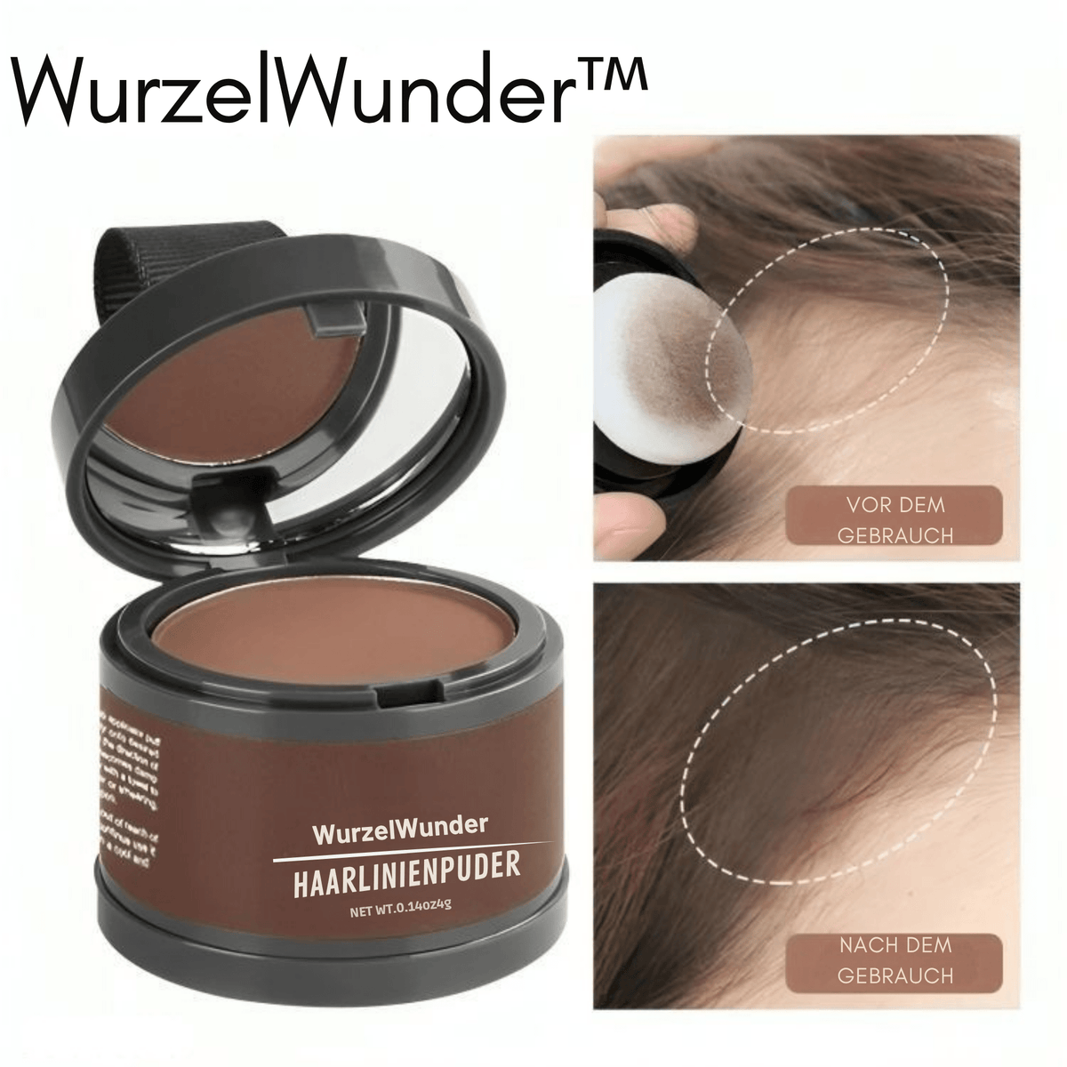 WurzelWunder™ / Kein Nachwachsen Mehr! (1+1 GRATIS) - Sopheria