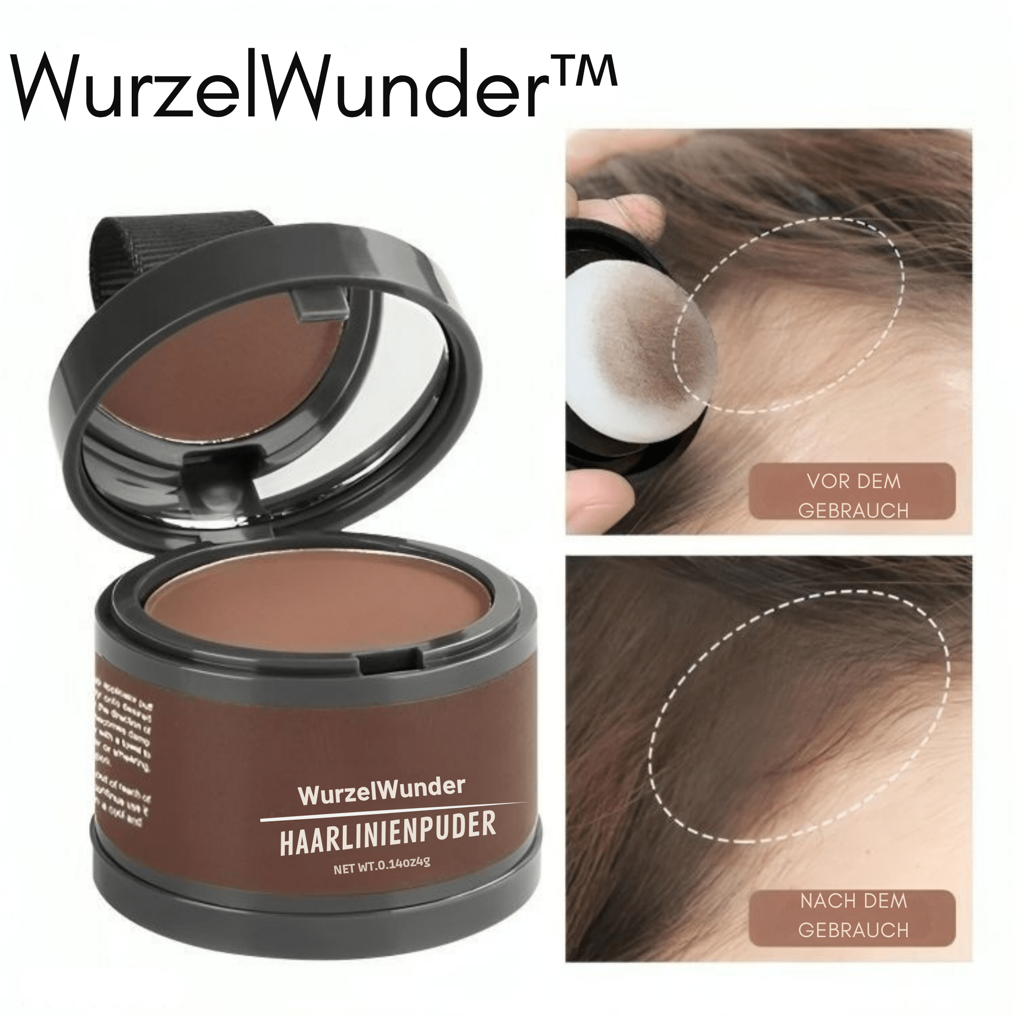 WurzelWunder™ / Kein Nachwachsen Mehr! (1+1 GRATIS) - Sopheria